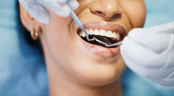 Best Same-Day Emergency Dental Services in Premont, TX